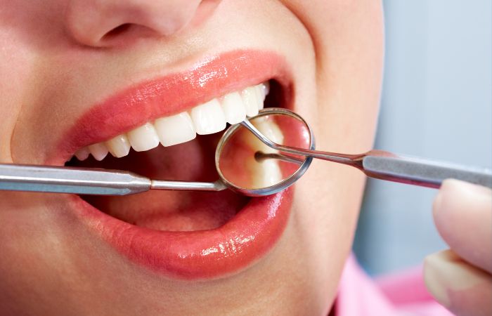 Dental Checkups For Healthy Teeth